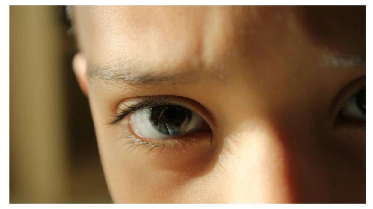 Perhatikan! 4 Perubahan pada Wajah Ini Bisa Jadi Tanda Masalah Kesehatan