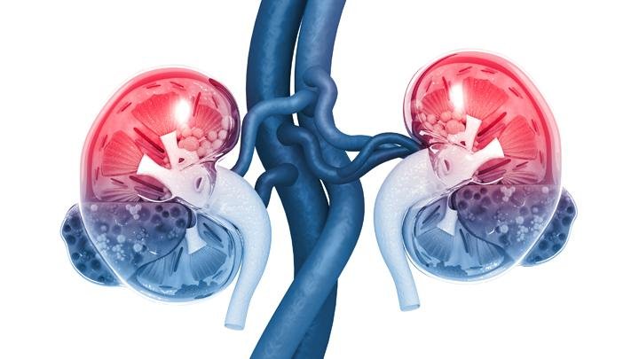 Gejala Penyakit Ginjal yang Tak Terduga: Perhatikan Tanda-tandanya di Mulut Anda