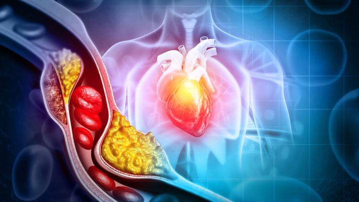 5 Minuman Alami untuk Mengurangi Kolesterol Anda